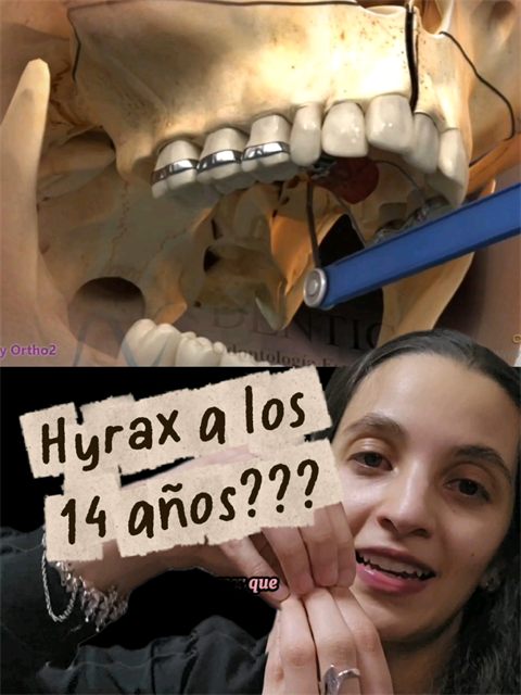 Portada de la lista Hyrax